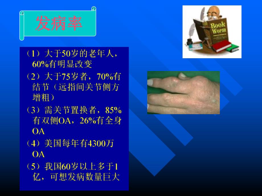 骨性关节炎ppt幻灯片.ppt_第3页