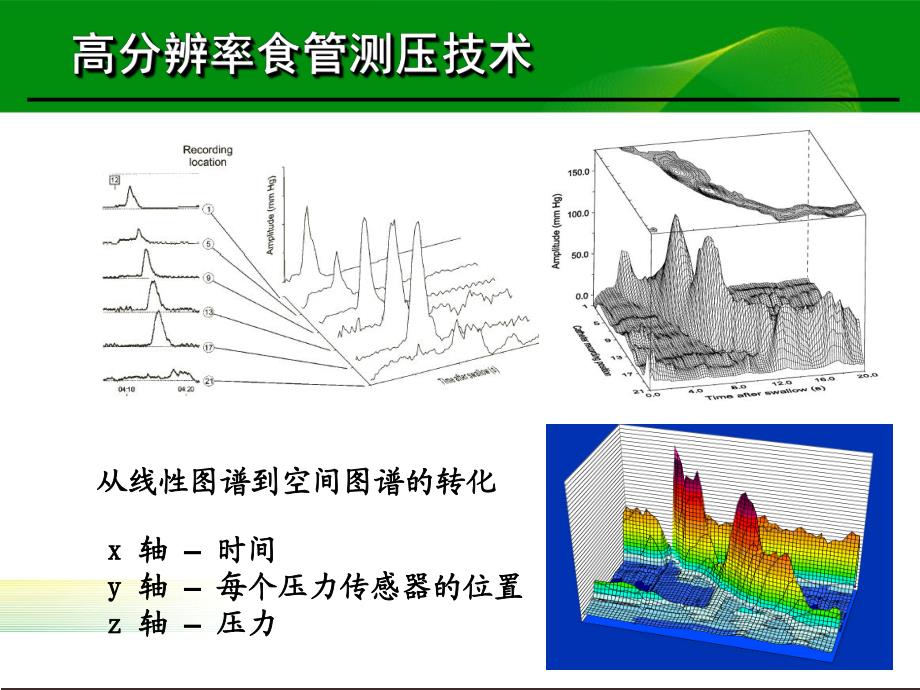 高分辨率食管测压检测技术的临床应用.ppt_第2页