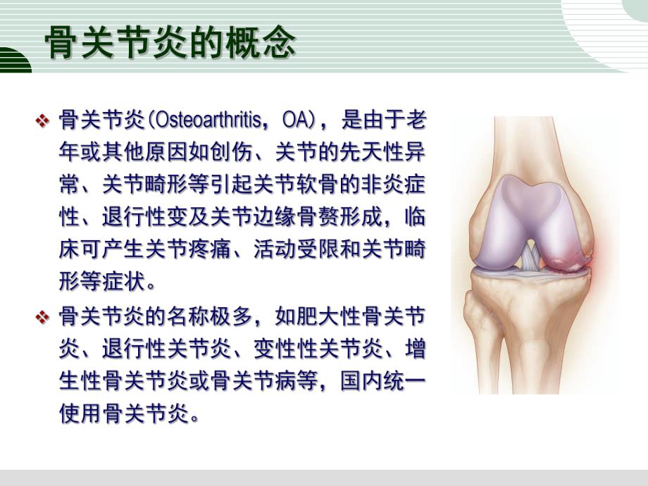 骨关节炎的诊治.ppt_第2页