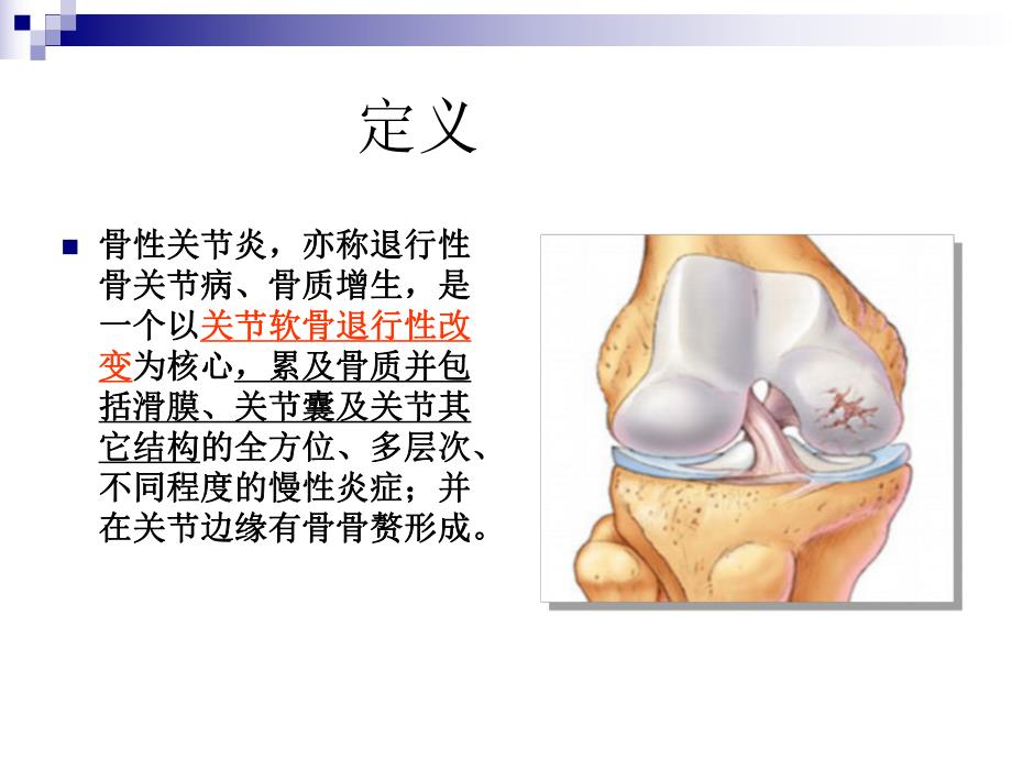 退行性骨关节疾病的诊断治疗.ppt_第2页