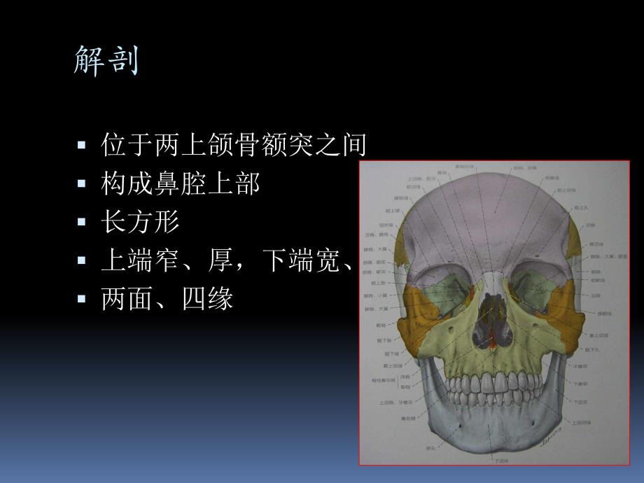 鼻骨骨折影像学诊断与鉴别.ppt_第2页