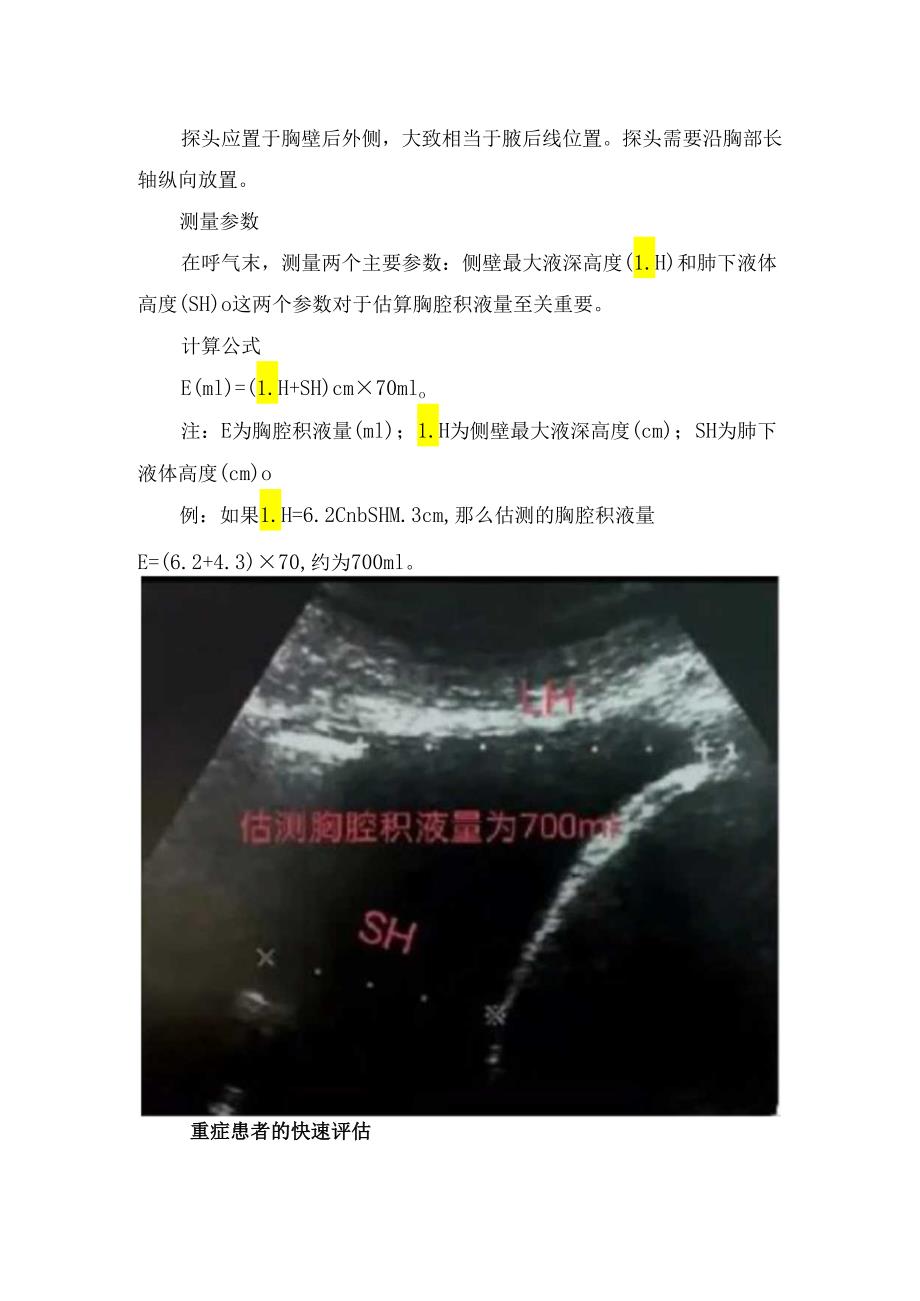 临床胸腔积液超声诊断及定量测量要点.docx_第3页