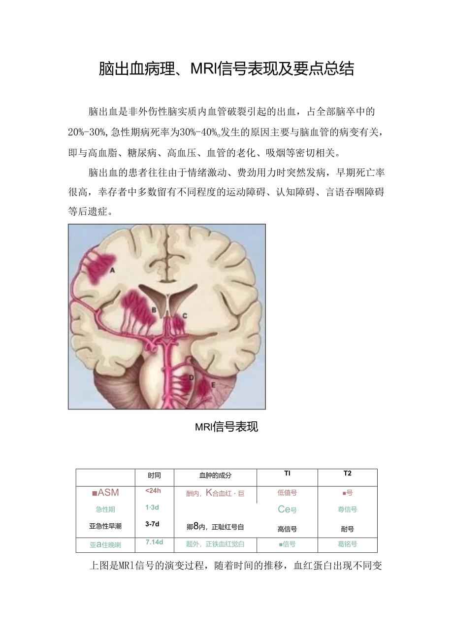 脑出血病理、MRI信号表现及要点总结.docx_第1页