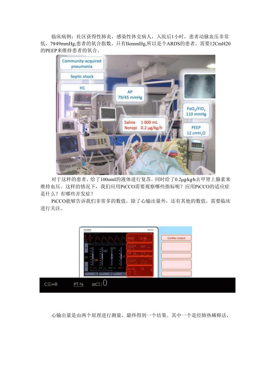 PiCCO在ICU中的应用探讨.docx_第1页