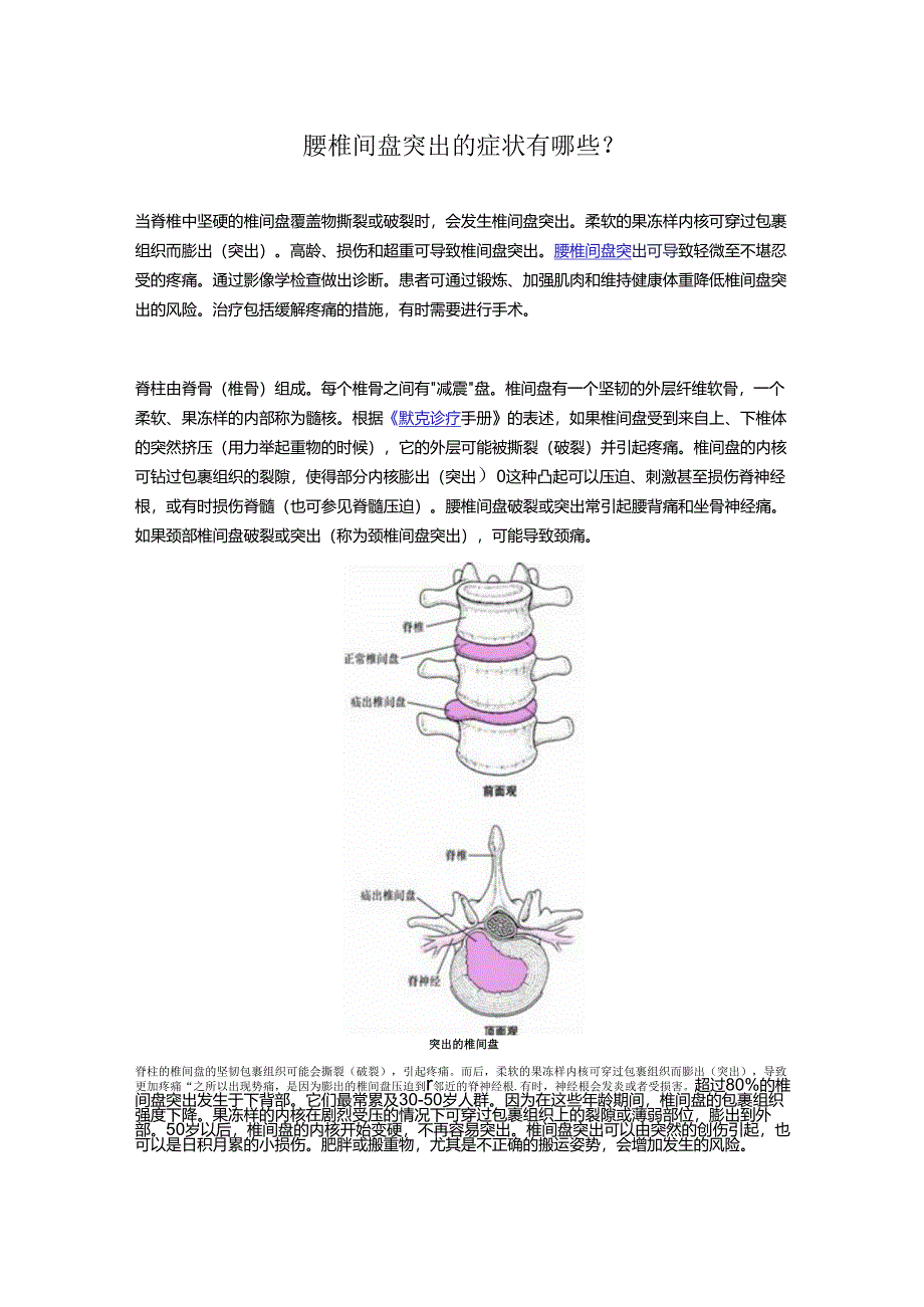 腰椎间盘突出的症状有哪些？.docx_第1页