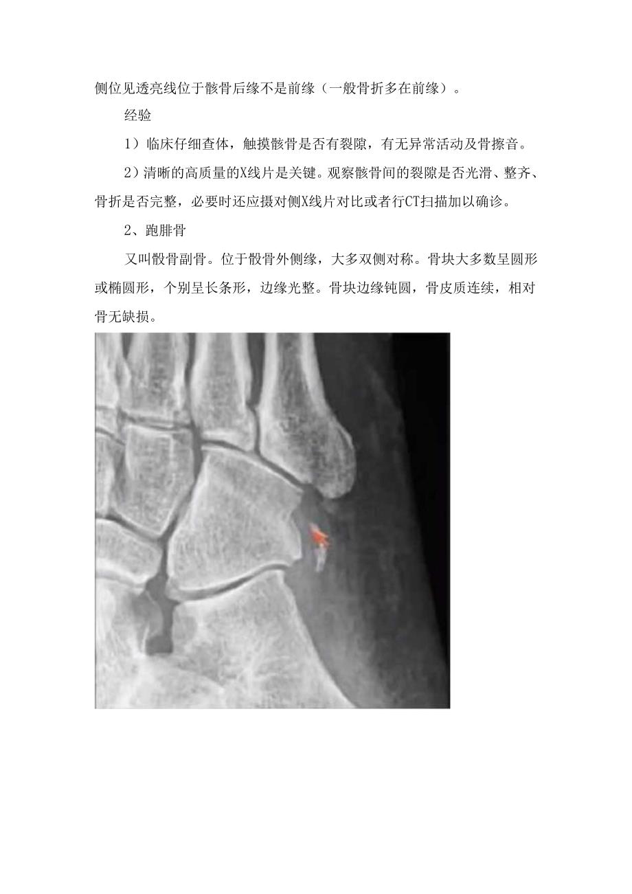 临床撕脱性骨折定义与影像学特征、易与撕脱性骨折混淆骨结构及常见副骨部位.docx_第3页