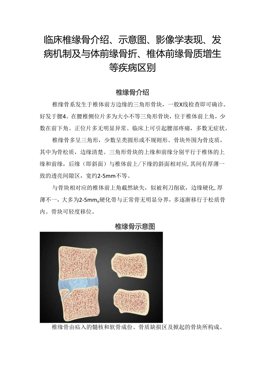 临床椎缘骨介绍、示意图、影像学表现、发病机制及与体前缘骨折、椎体前缘骨质增生等疾病区别.docx_第1页