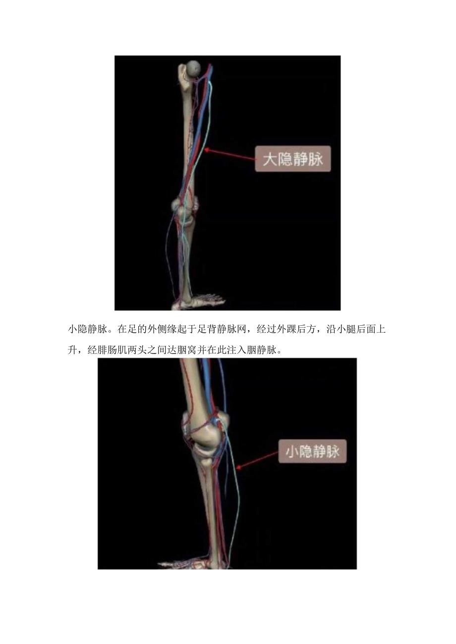 髂静脉及下肢静脉结构、髂静脉及下肢静脉血栓性病变超声检查要点及髂总静脉压迫综合征分型和临床表现.docx_第2页