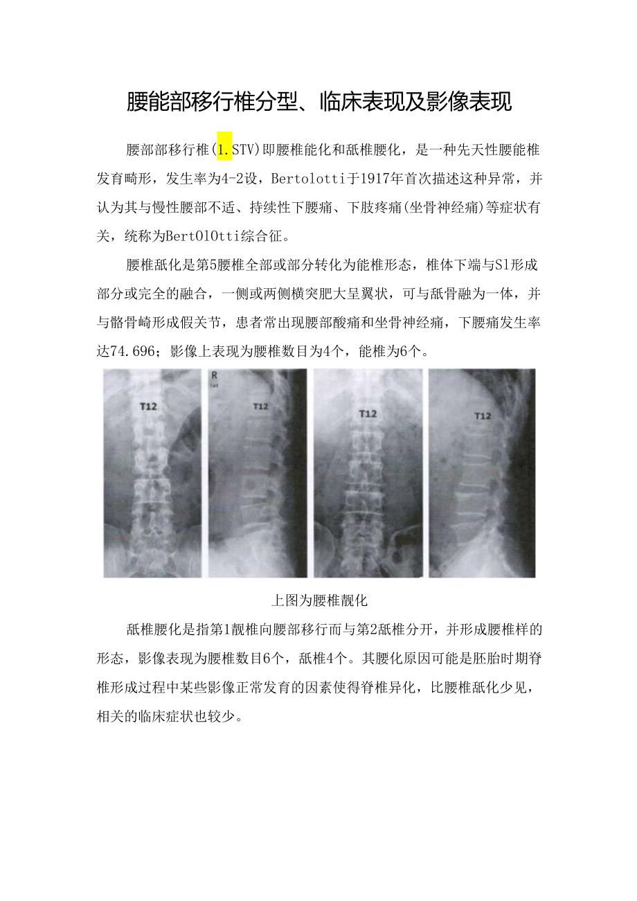 腰骶部移行椎分型、临床表现及影像表现.docx_第1页