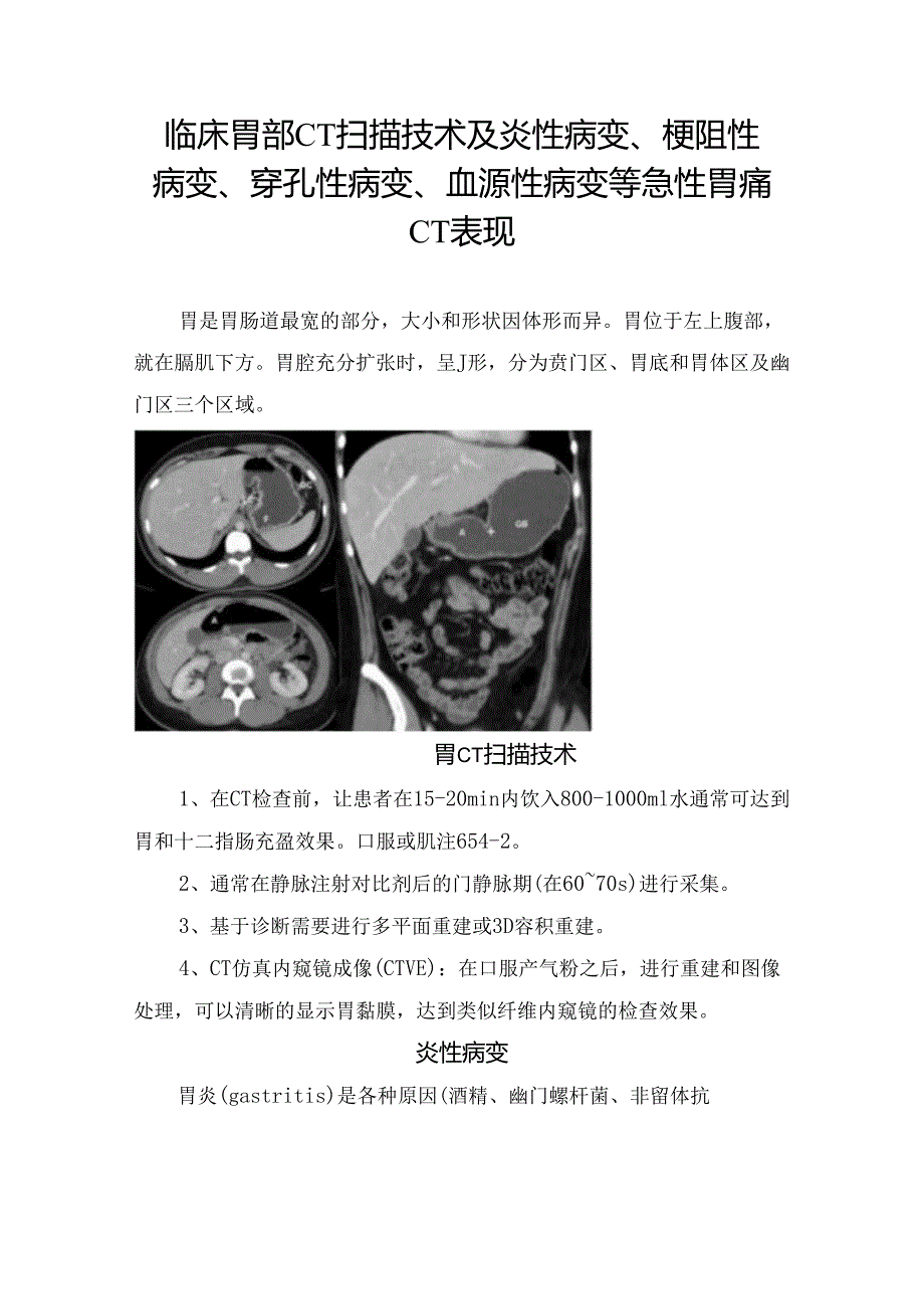 临床胃部CT扫描技术及炎性病变、梗阻性病变、穿孔性病变、血源性病变等急性胃痛CT表现.docx_第1页