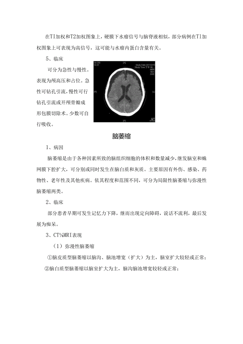 临床硬膜下积液与脑萎缩疾病高发年龄、病因、影像学特征及临床表现.docx_第2页