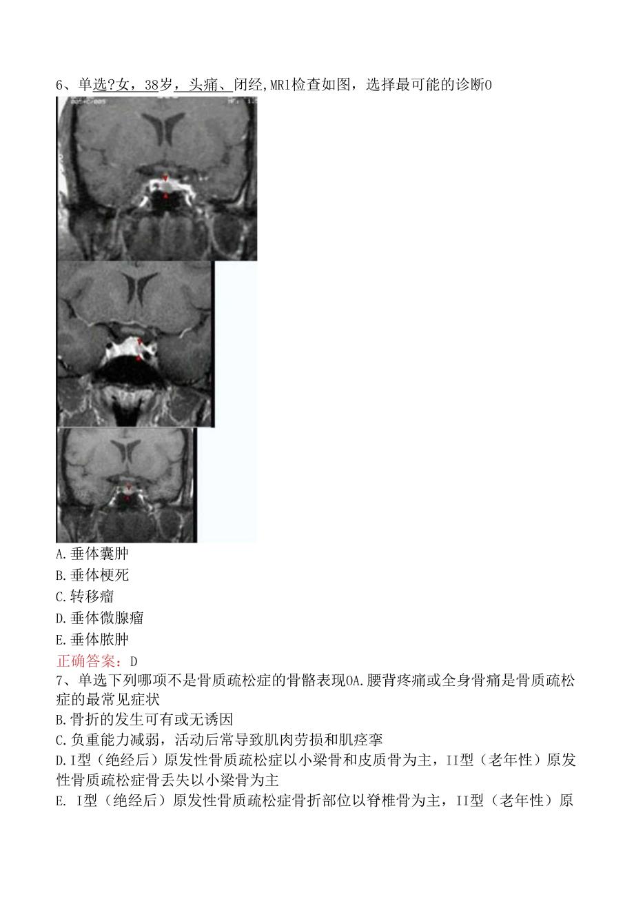 内分泌学(医学高级)：内分泌学(医学高级)题库一.docx_第3页