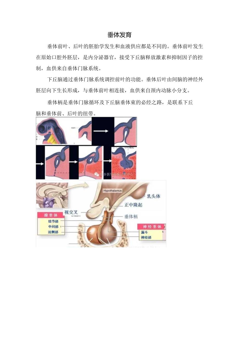 临床垂体柄阻断综合征概述、发病机制、临床表现、影像学表现及垂体发育病理.docx_第2页