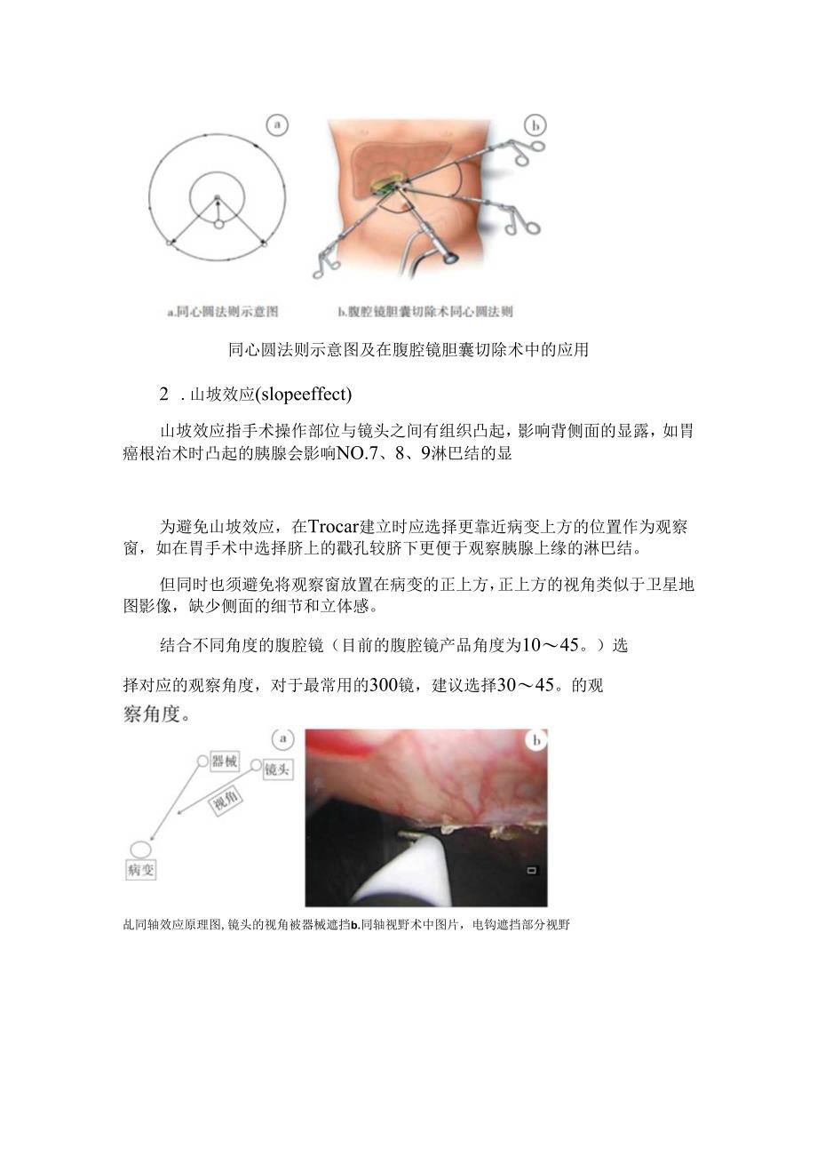 临床Trocar置放原则及位置选择.docx_第2页