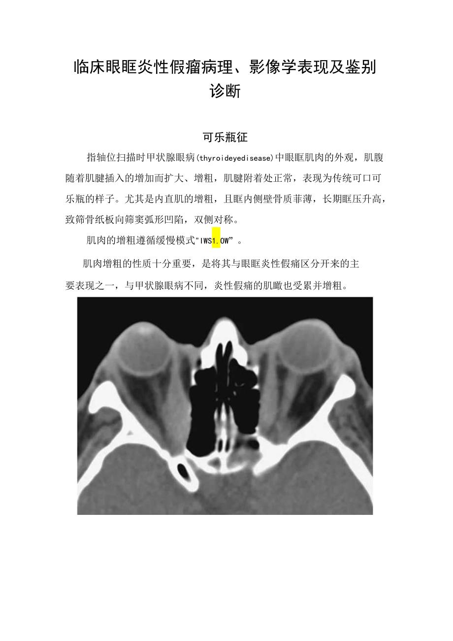 临床眼眶炎性假瘤病理、影像学表现及鉴别诊断.docx_第1页