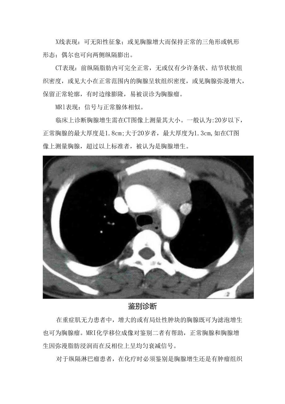 临床胸腺增生概述、病理、临床表现、诊断、影像表现及鉴别诊断.docx_第2页