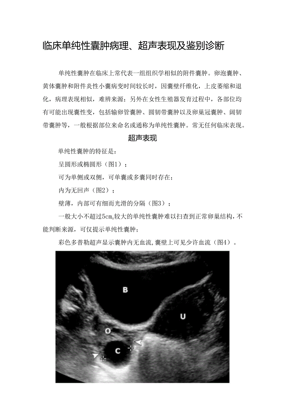 临床单纯性囊肿病理、超声表现及鉴别诊断.docx_第1页