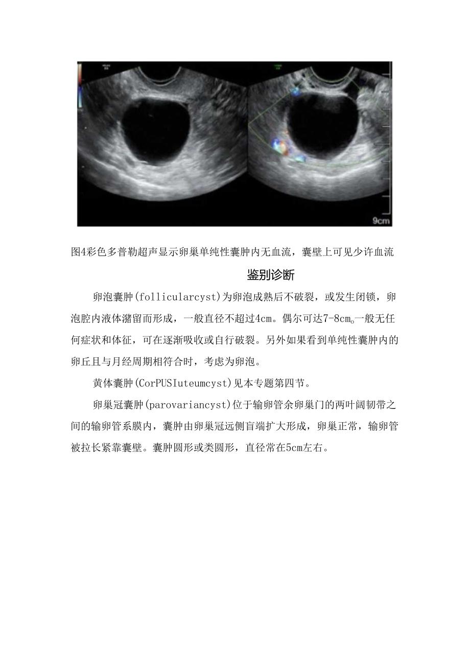 临床单纯性囊肿病理、超声表现及鉴别诊断.docx_第3页