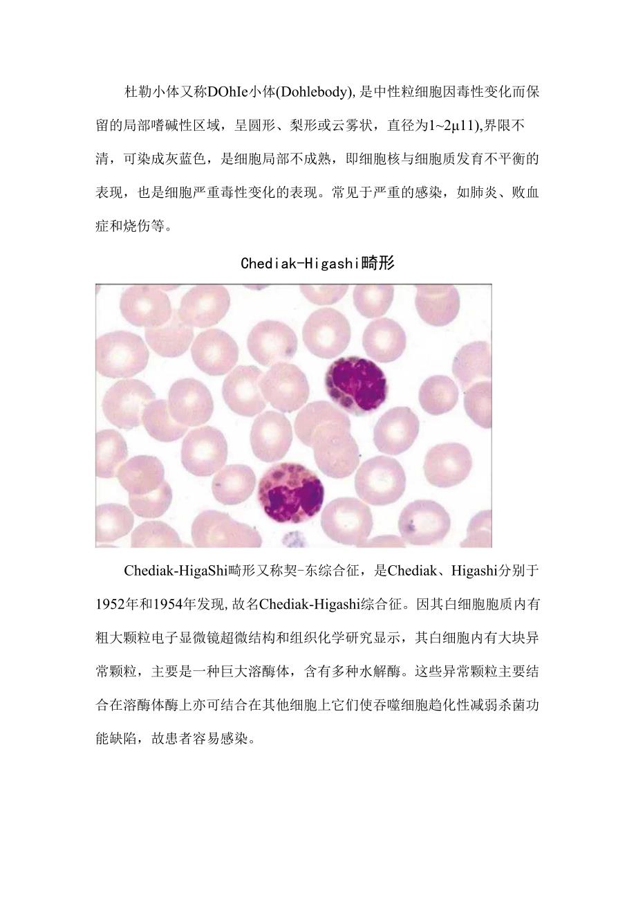 临床Auer小体、杜勒小体、中毒颗粒、空泡等白细胞内小体指示意义.docx_第2页