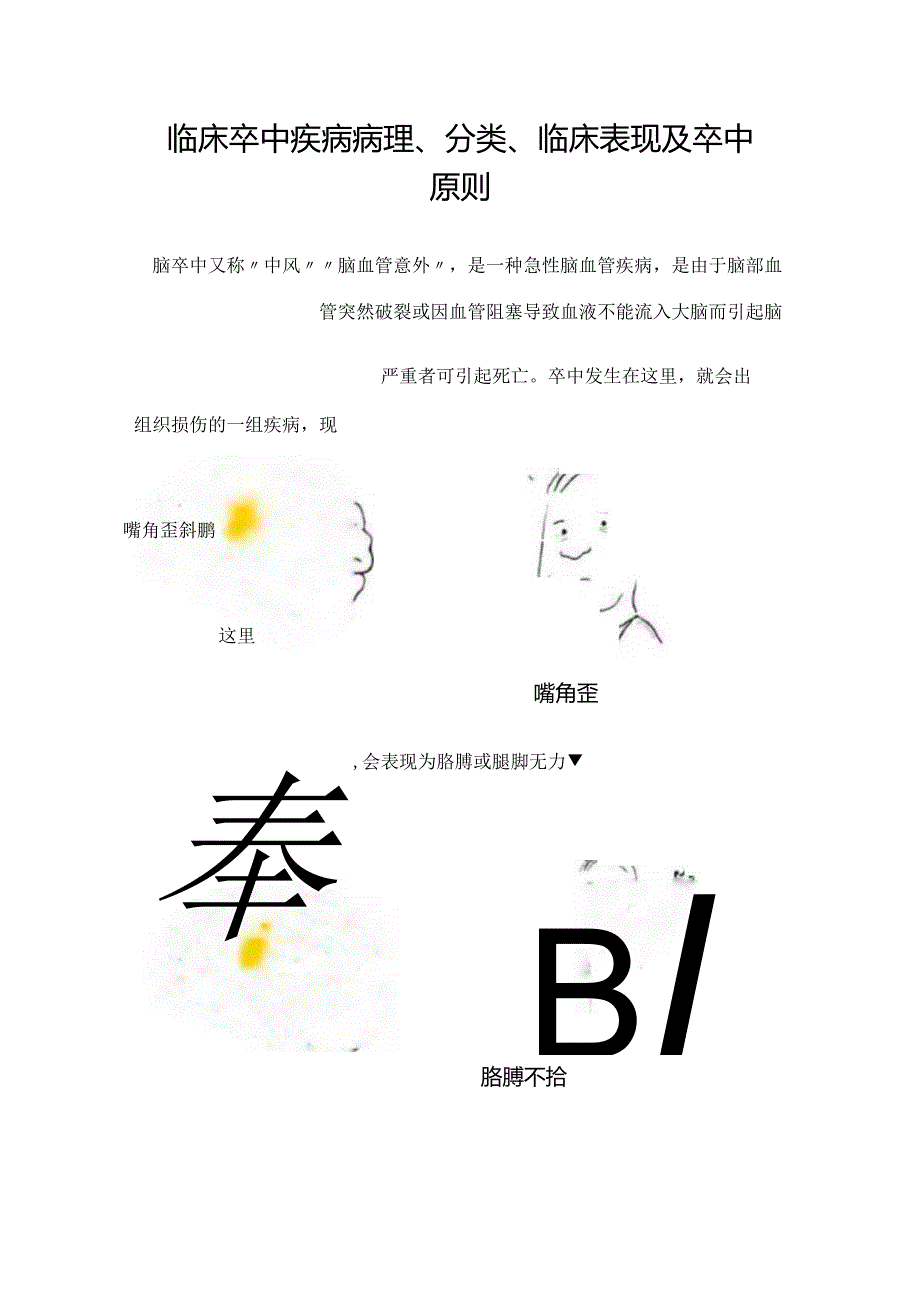 临床卒中疾病病理、分类、临床表现及卒中原则.docx_第1页