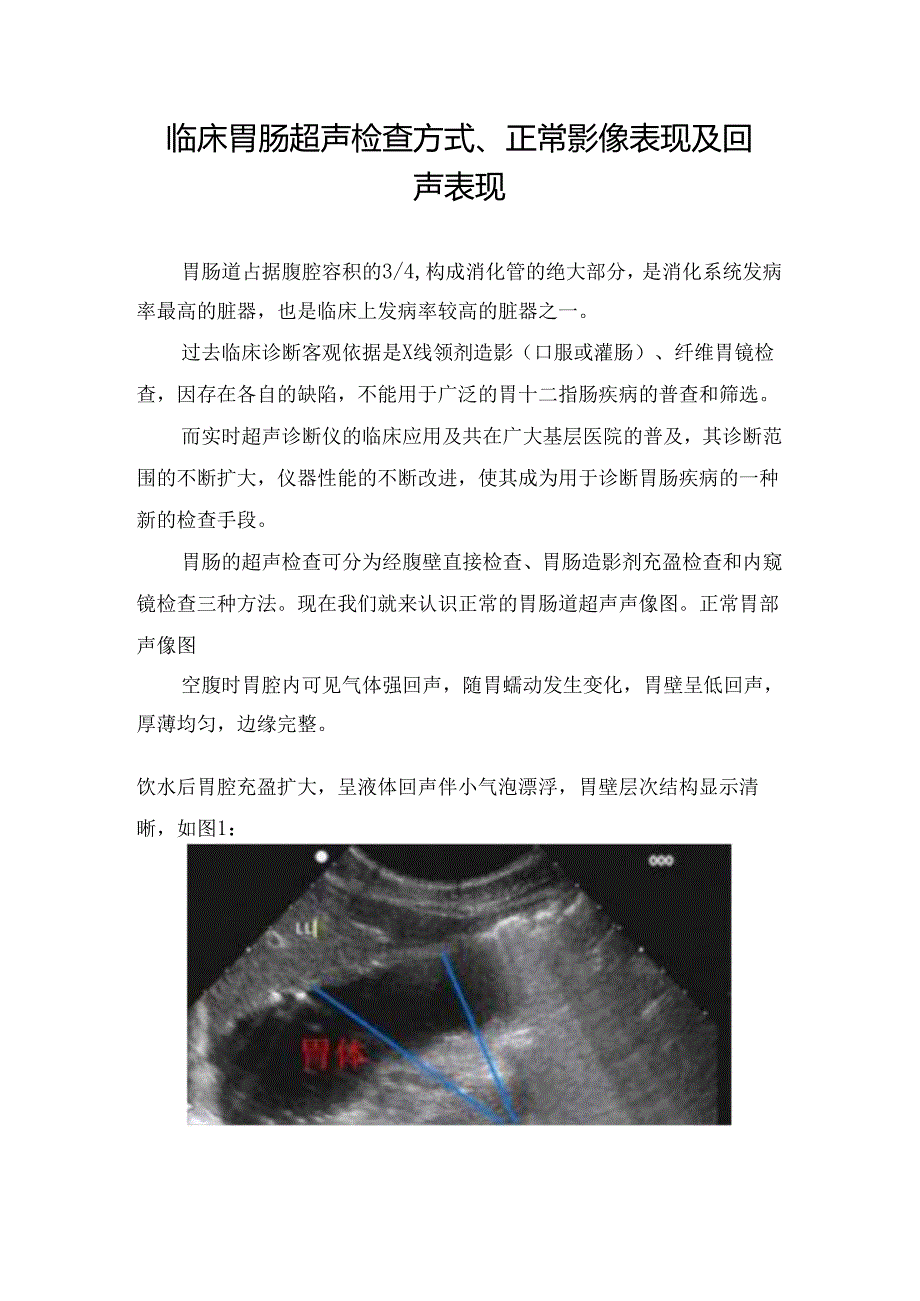 临床胃肠超声检查方式、正常影像表现及回声表现.docx_第1页