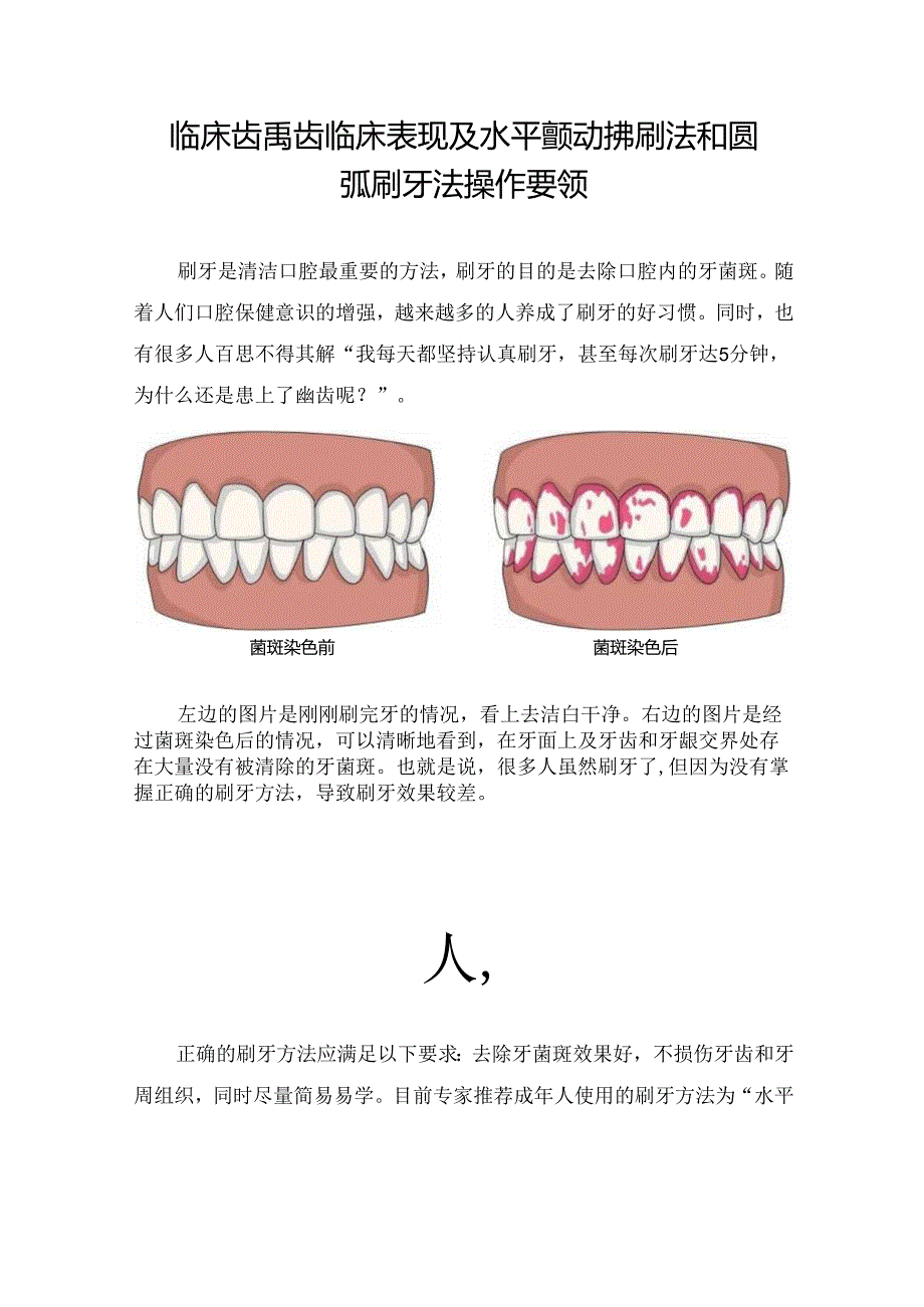 临床龋齿临床表现及水平颤动拂刷法和圆弧刷牙法操作要领.docx_第1页