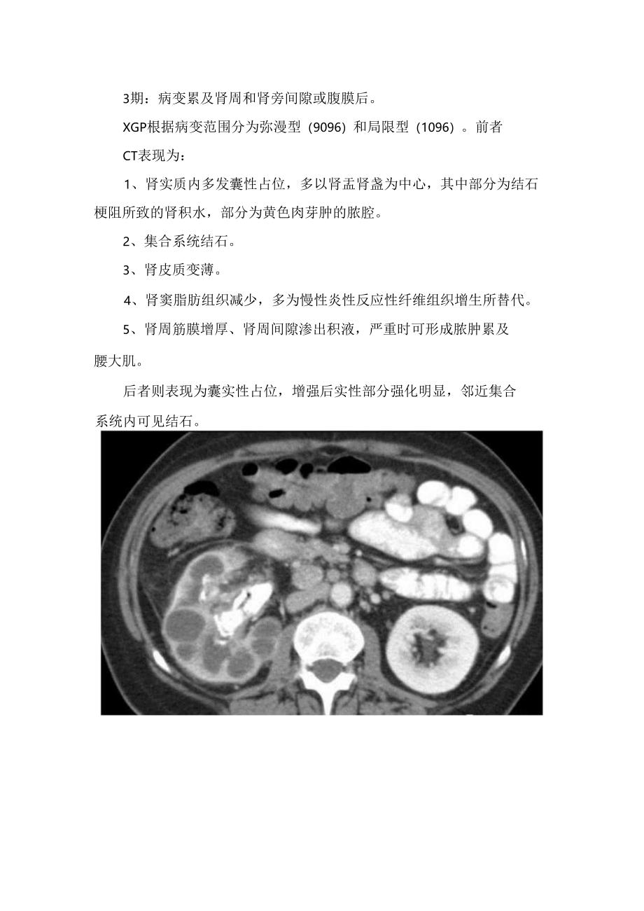 黃色肉芽肿性肾盂肾炎流行病学、临床表现、病理及影像学表现.docx_第2页