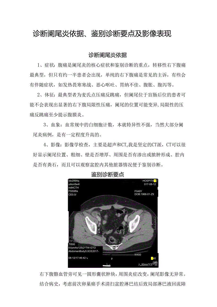 诊断阑尾炎依据、鉴别诊断要点及影像表现.docx_第1页