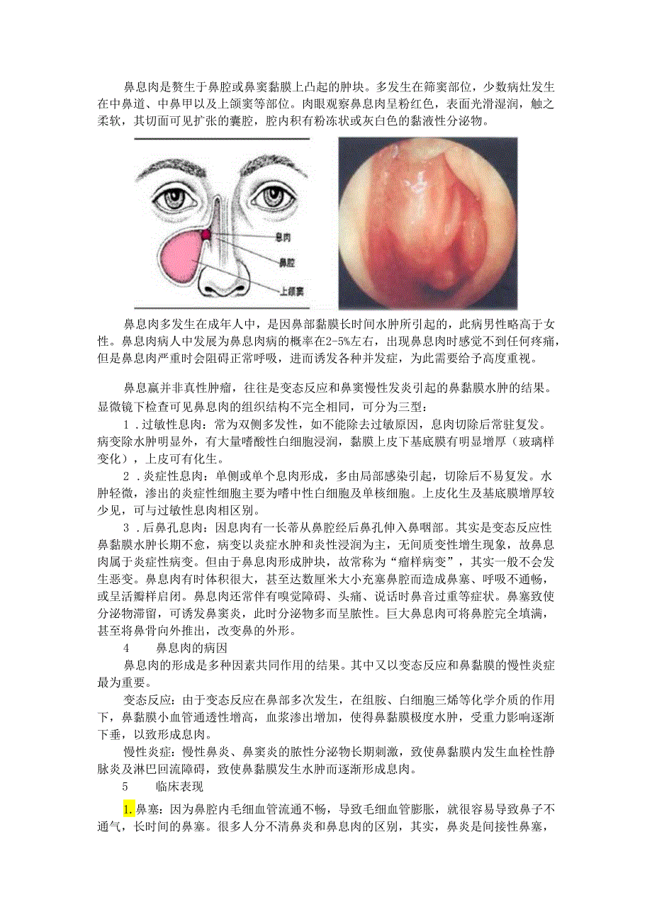 鼻息肉的诊断和治疗及并发症(探讨).docx_第1页