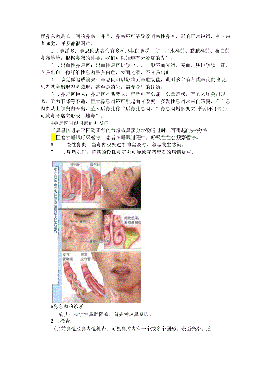 鼻息肉的诊断和治疗及并发症(探讨).docx_第2页