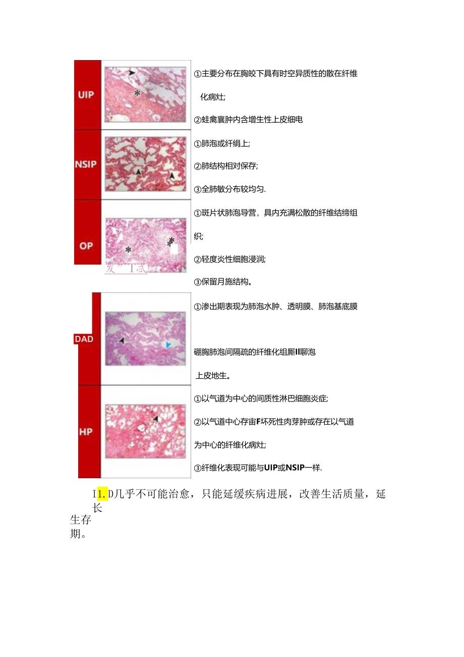 临床间质性肺病定义、分类、病理生理、治疗及影像学特征.docx_第2页