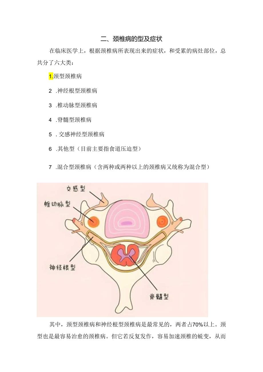 临床颈椎病分型、典型症状、生活中易致因素、治疗要点及简单颈椎保健操.docx_第2页