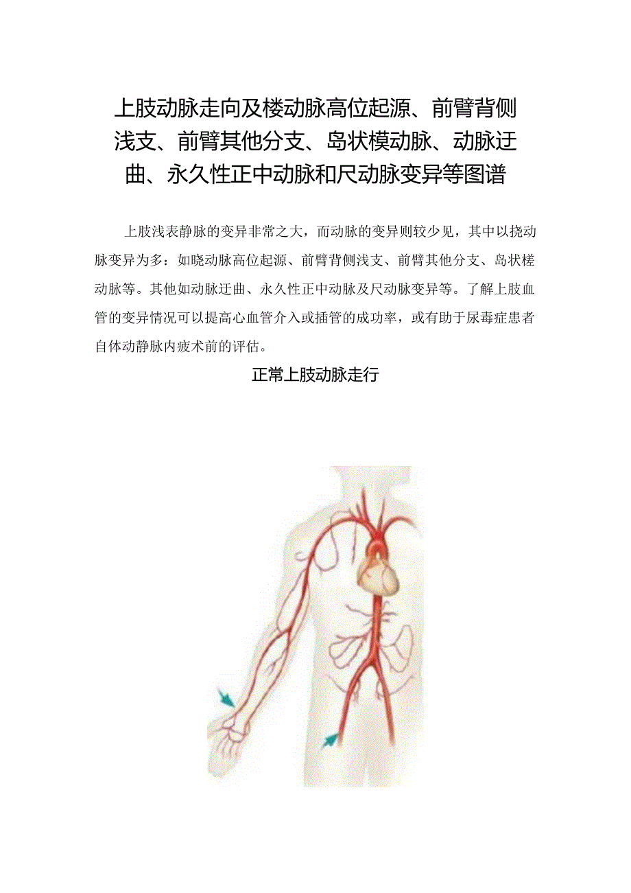 上肢动脉走向及桡动脉高位起源、前臂背侧浅支、前臂其他分支、岛状桡动脉、动脉迂曲、永久性正中动脉和尺动脉变异等图谱.docx_第1页