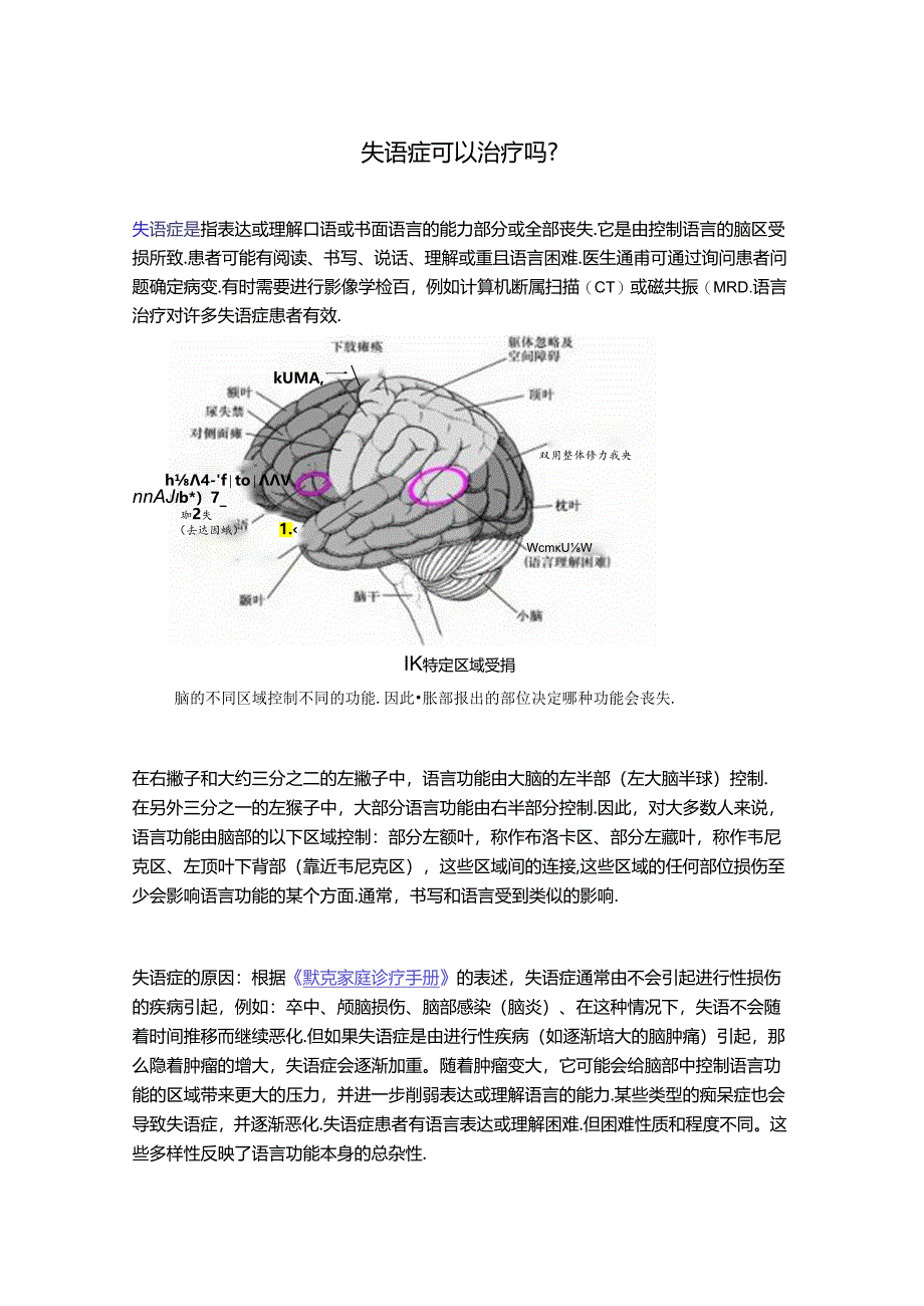 失语症可以治疗吗？.docx_第1页