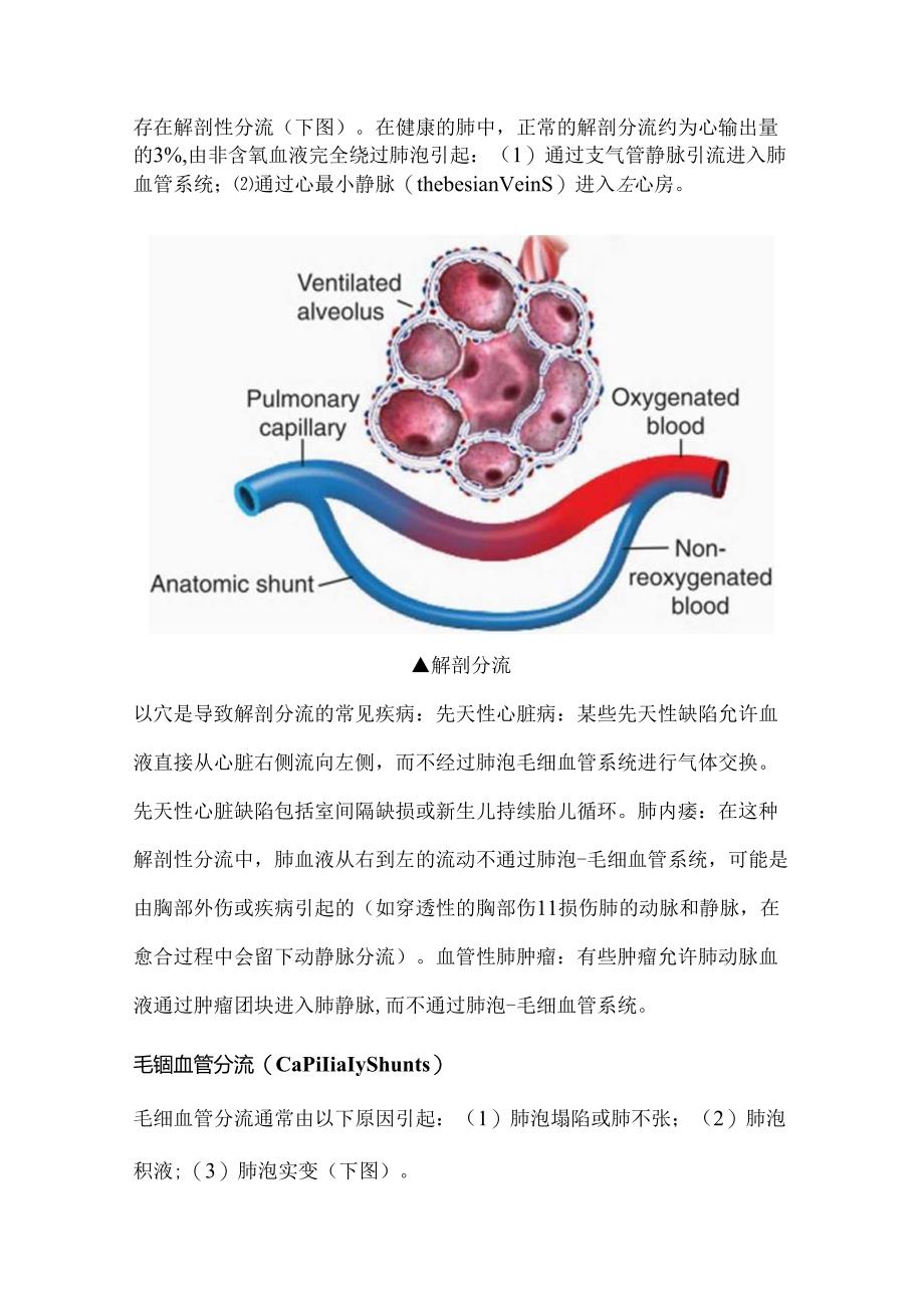 2024肺分流知识科普（附图表）.docx_第2页