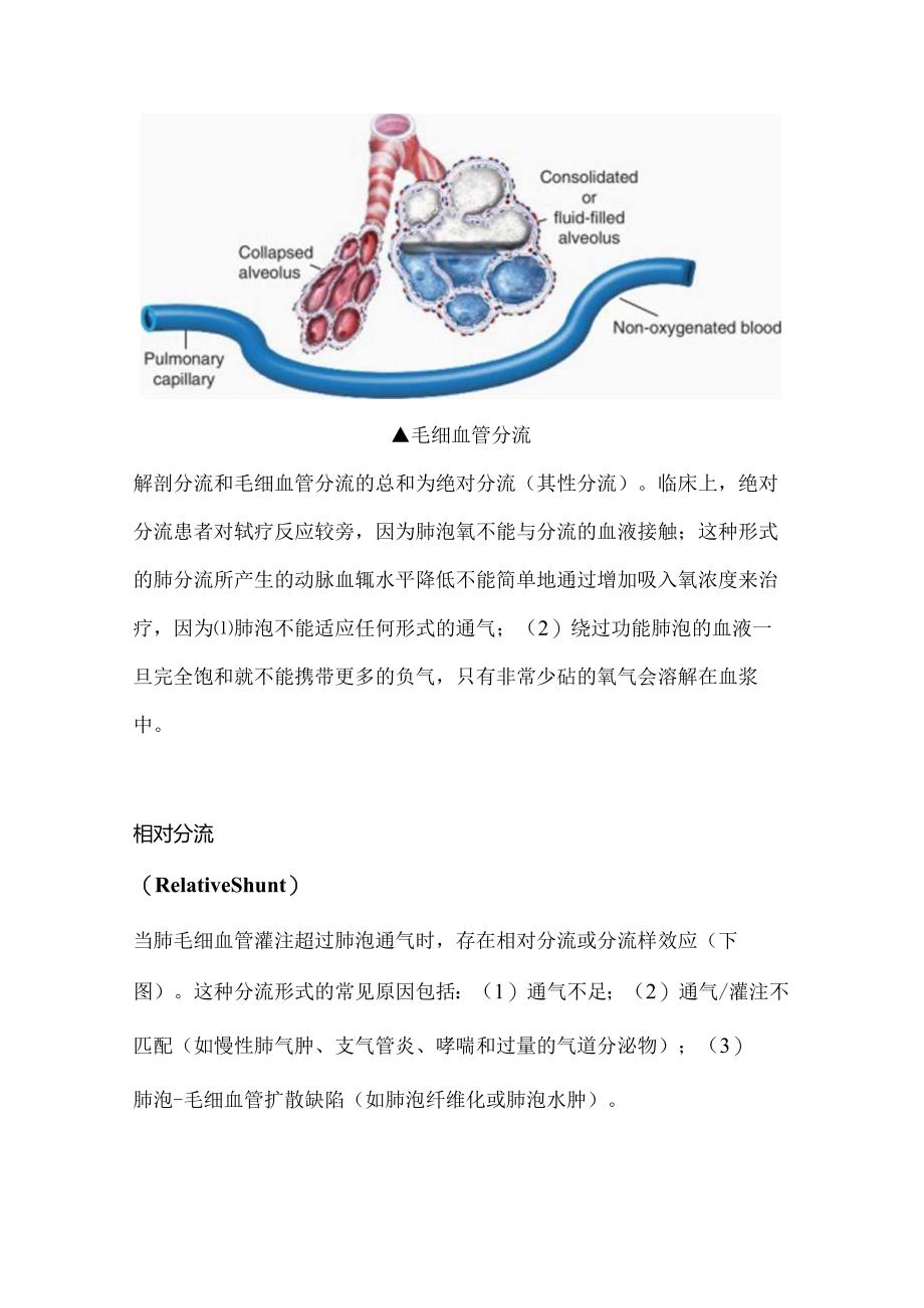 2024肺分流知识科普（附图表）.docx_第3页