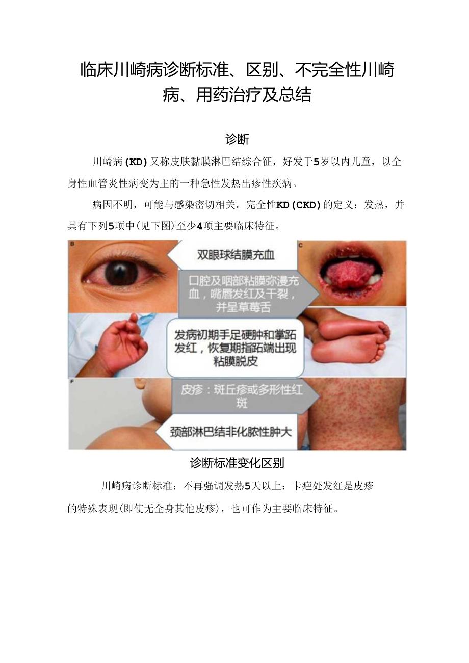 临床川崎病诊断标准、区别、不完全性川崎病、用药治疗及总结.docx_第1页