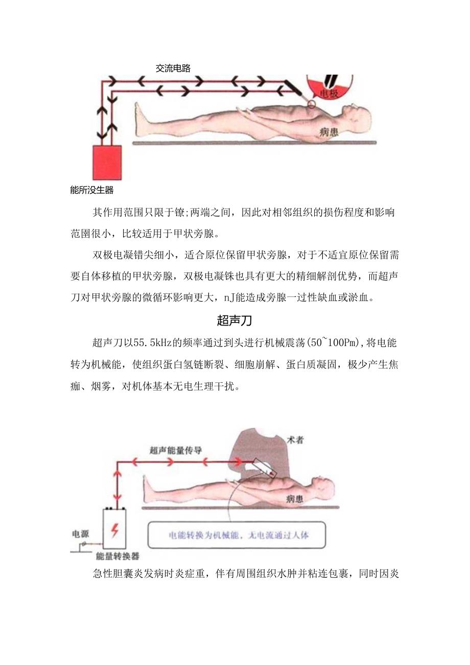 手术室单极、双极、超声刀、氩气刀病例、对比及注意事项.docx_第2页