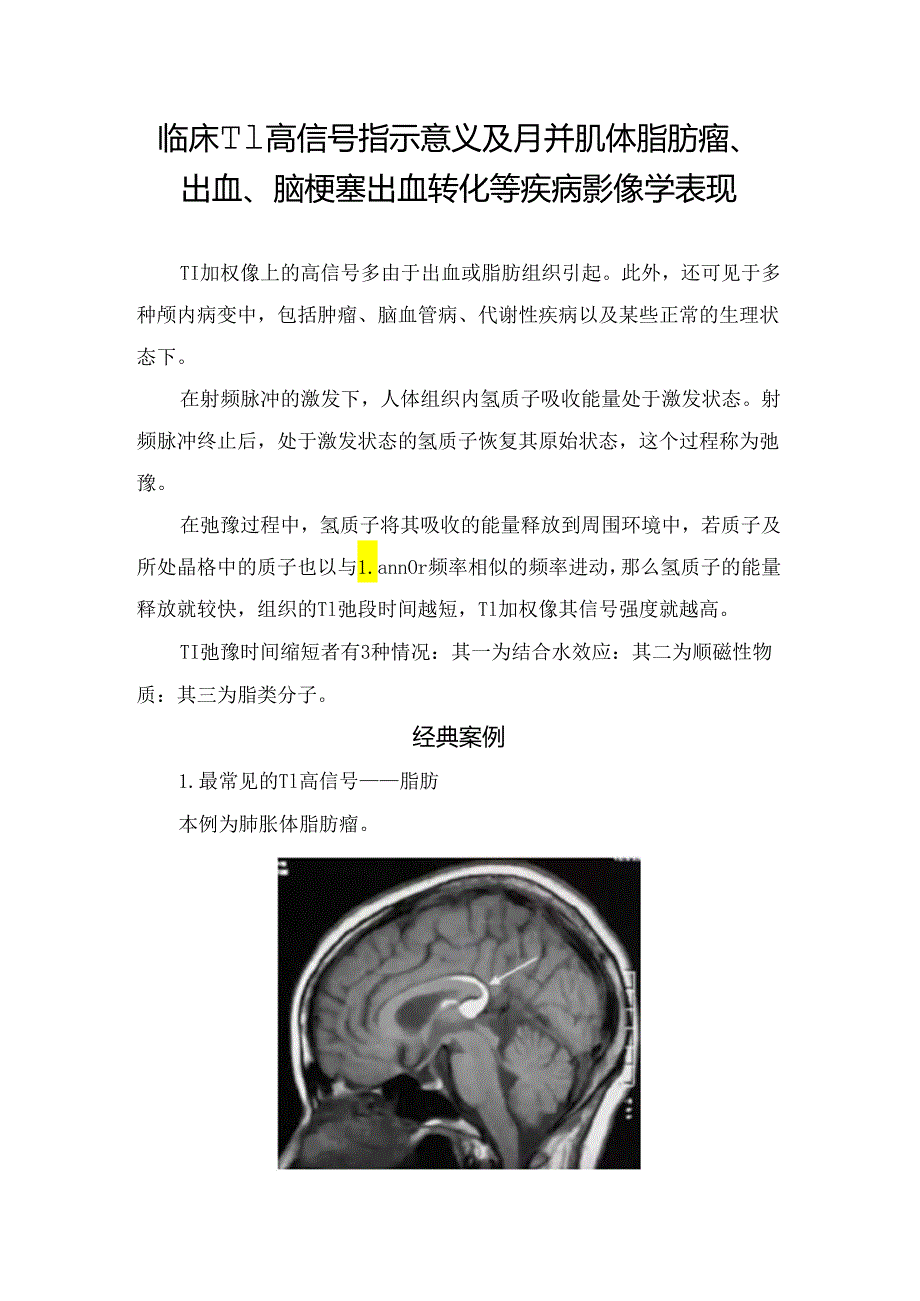 临床T1高信号指示意义及胼胝体脂肪瘤、出血、脑梗塞出血转化等疾病影像学表现.docx_第1页