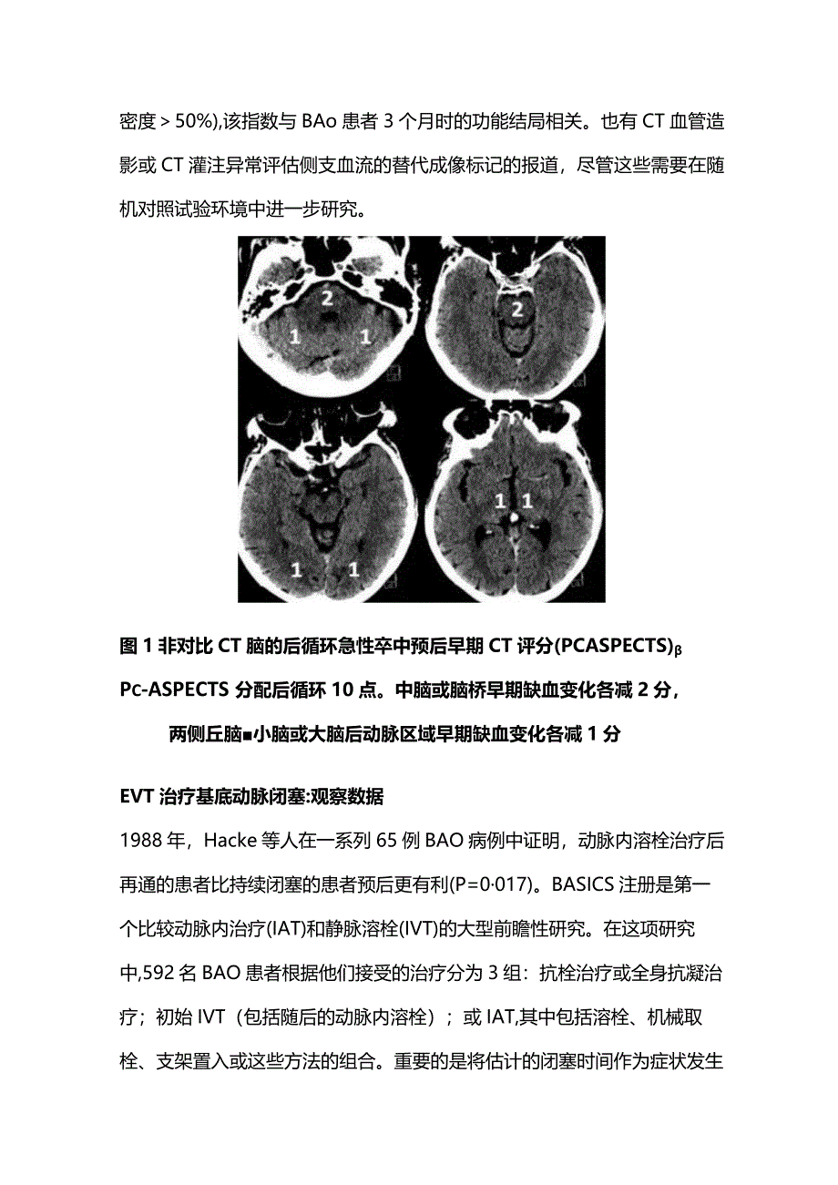 2024基底动脉闭塞的血管内治疗.docx_第3页