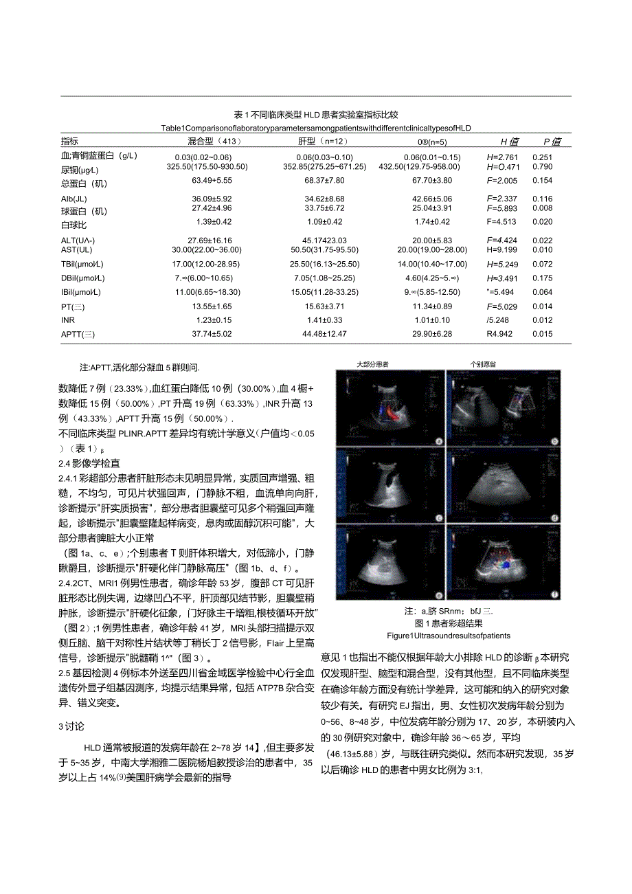 35岁以上肝豆状核变性患者的临床特征分析.docx_第3页