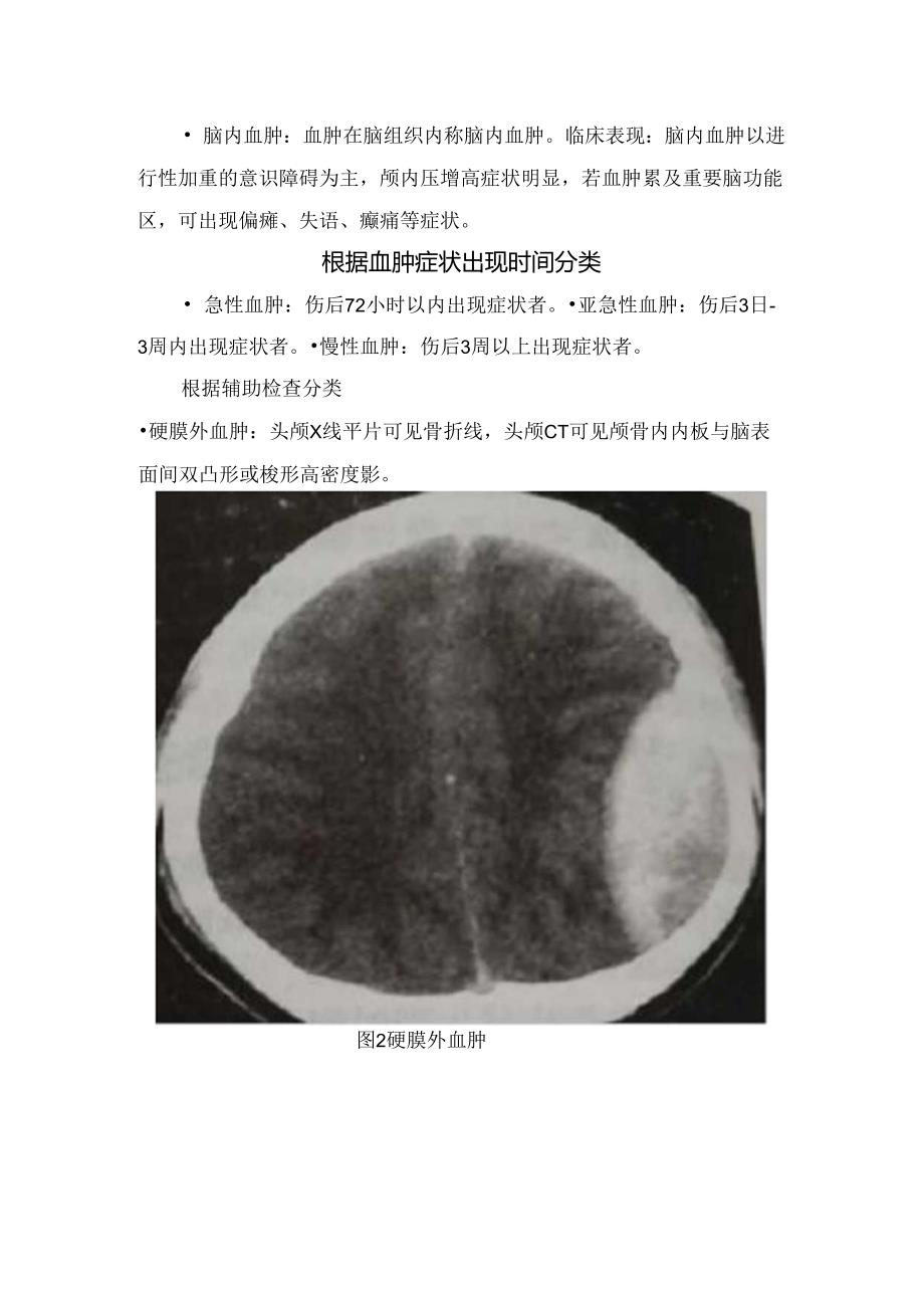 常见颅内血肿特征、源、部位、临床表现及治疗要点.docx_第2页