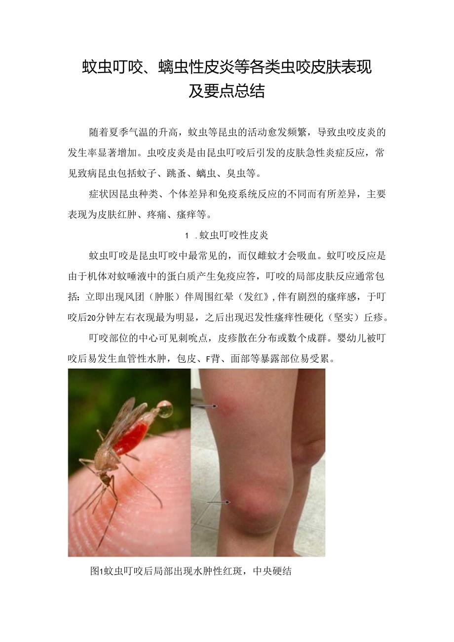 蚊虫叮咬、螨虫性皮炎等各类虫咬皮肤表现及要点总结.docx_第1页