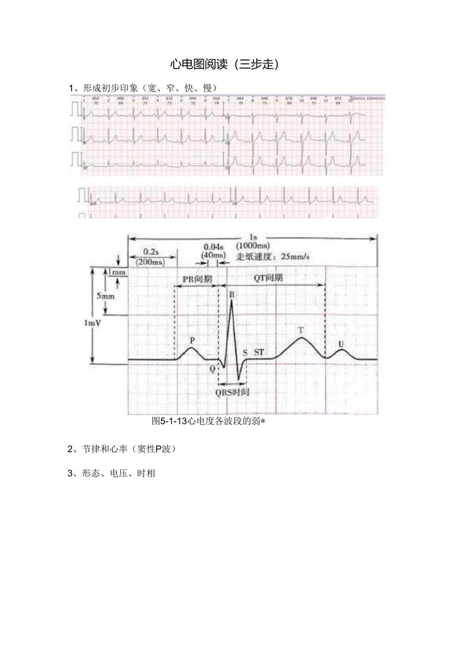 临床常规导联位置、心电图阅读、心律、电轴、PR间期、P波等心电图基础知识要点.docx_第2页