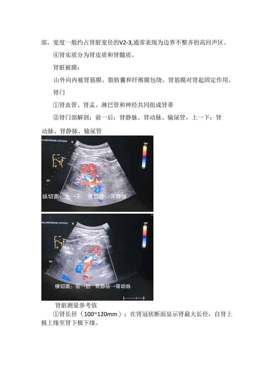 临床肾脏超声解剖要点.docx_第2页