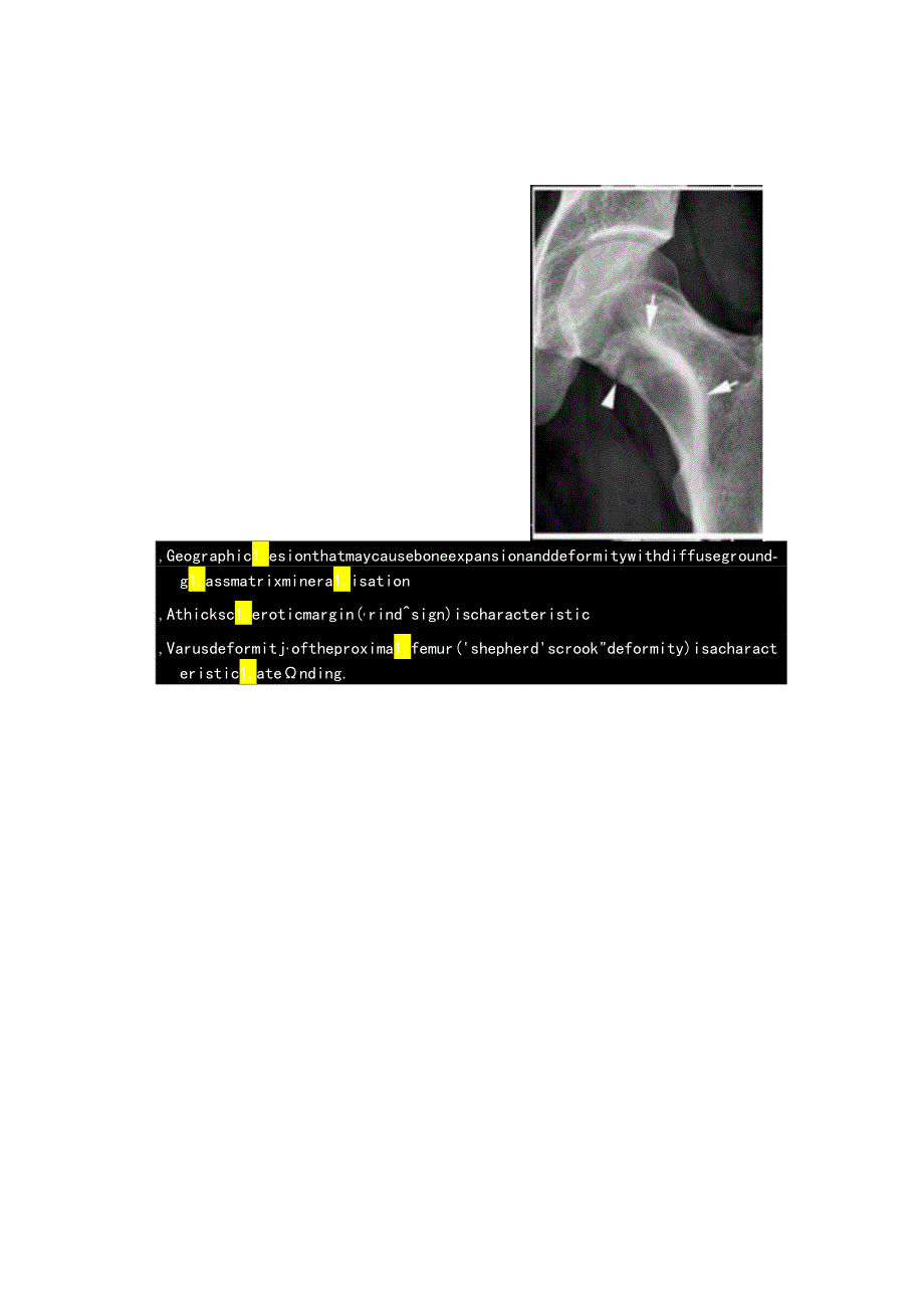 临床纤维异常增殖症病理及影像学表现.docx_第3页