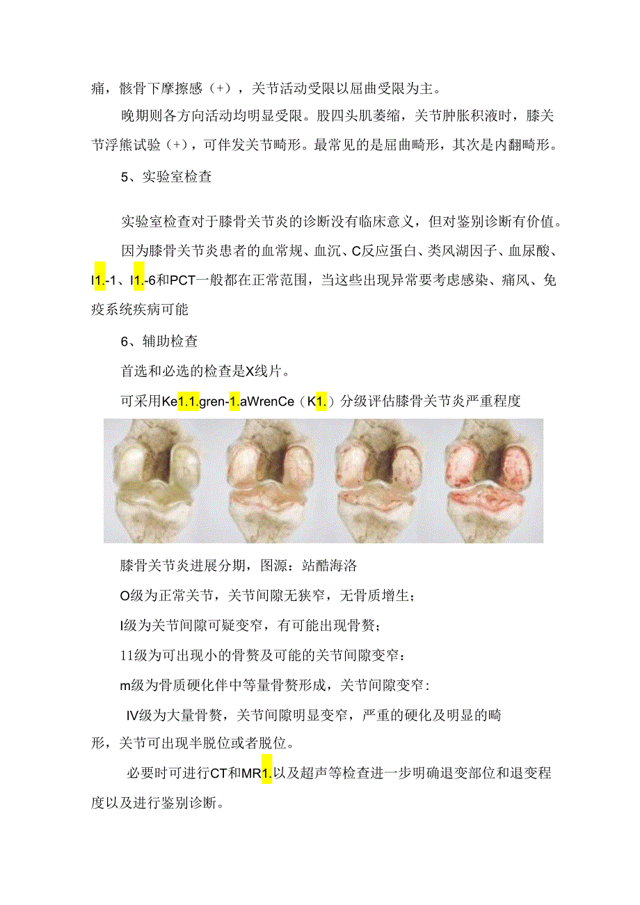 临床骨科膝关节炎病理、诊断及治疗要点.docx_第3页