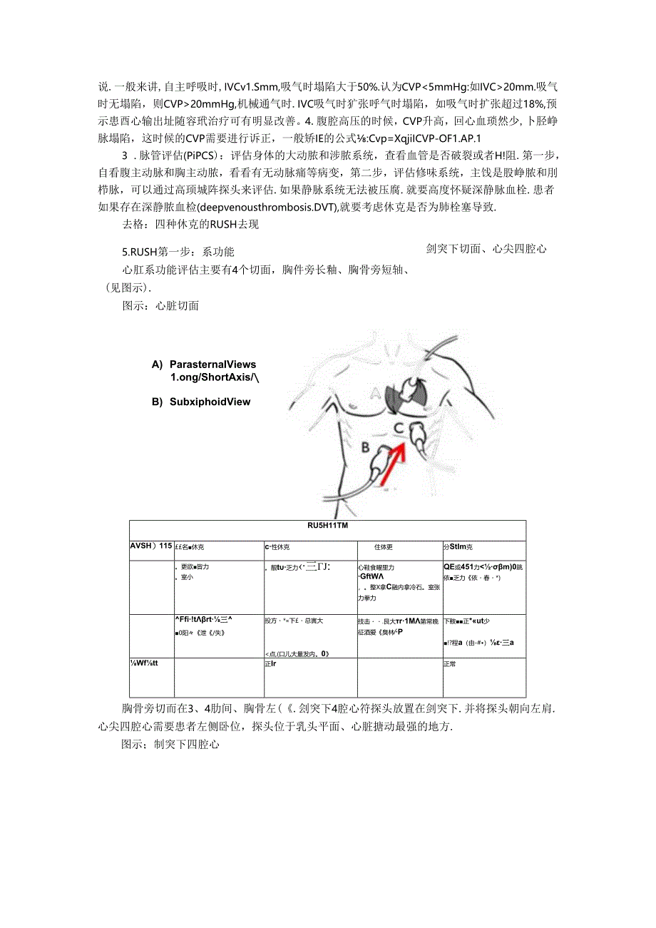 超声诊断休克的RUSH方案 文字版.docx_第2页