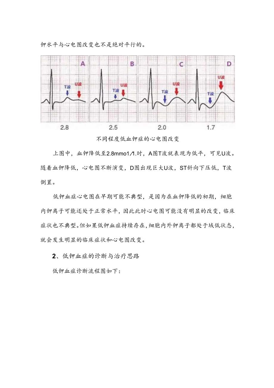 不容小觑的低钾血症的诊疗思路.docx_第2页