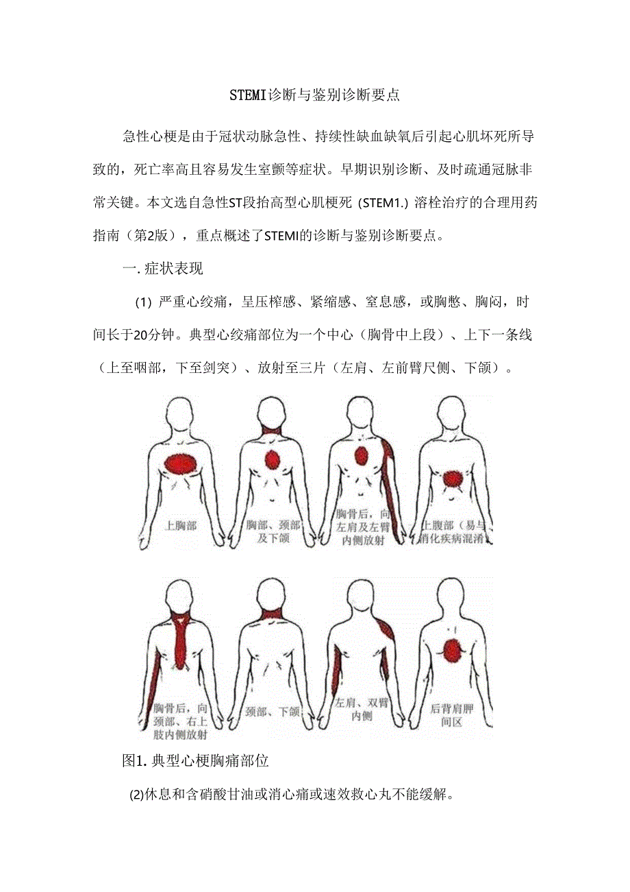 STEMI诊断与鉴别诊断要点.docx_第1页